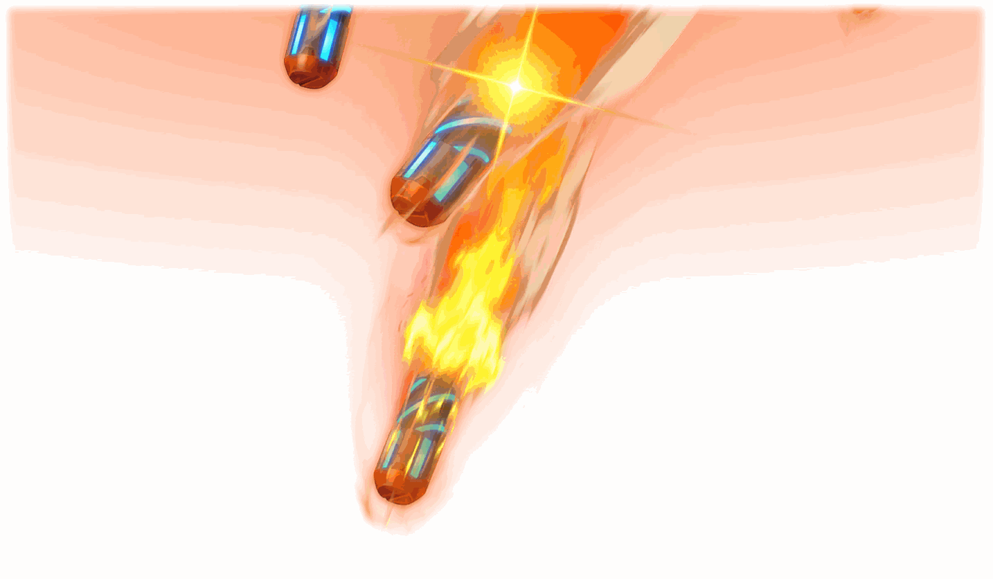 Mesotron-S-Angriff Heaven Breaker